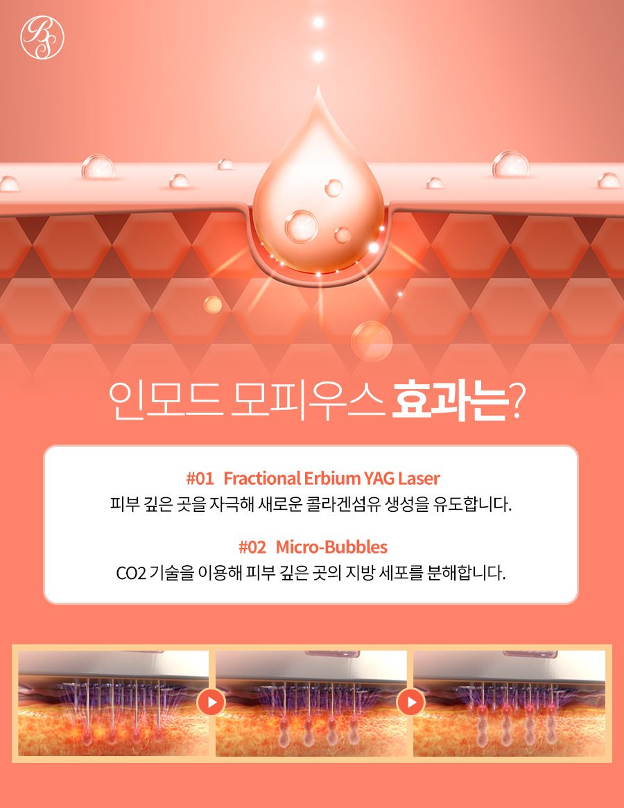 코엑스피부과 인모드 모피우스8 효과와 주의사항까지 관련 이미지 8