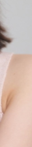 삼성역보톡스 시술 전 알아두면 좋은 정보 관련 이미지 28