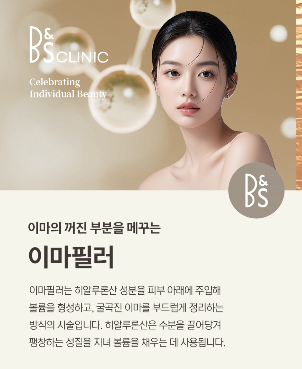 삼성동이마필러, 볼륨과 주름개선으로 매끄러운 인상 관련 이미지 2