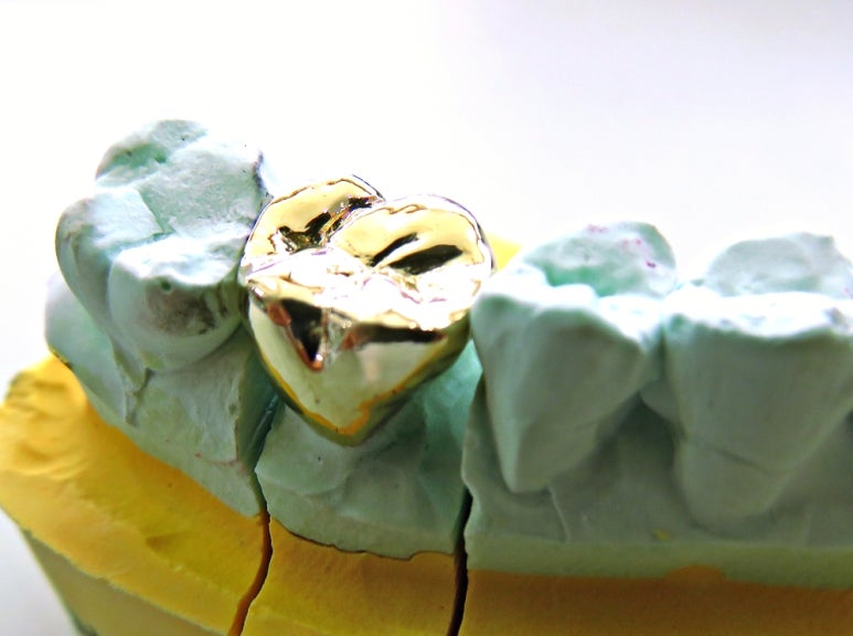 Does Green Tea Help Dental Health? image 6