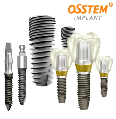 Implants Have Nothing to Do with Age. image 6