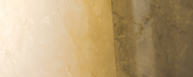 Implants: Treatment Timing and Aftercare Are Important! image 27