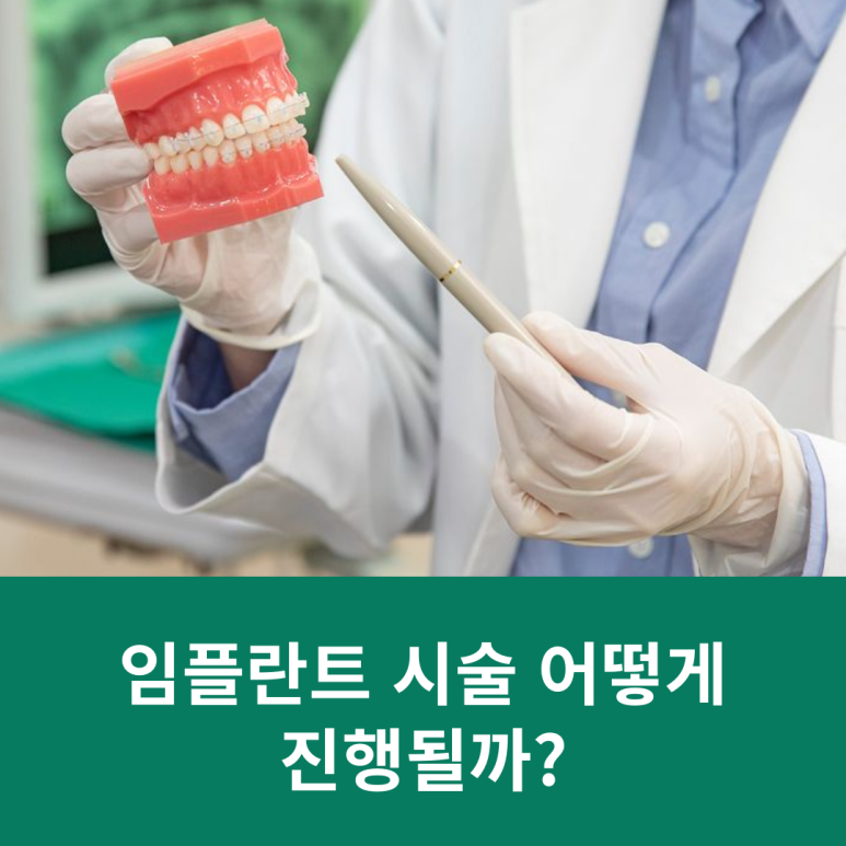 임플란트 시술 어떻게 진행될까? 관련 이미지 9