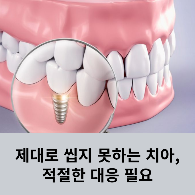 Teeth That Cannot Chew Properly Need Appropriate Care image 4