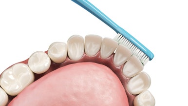 Implant Lifespan: Using It Longer with Proper Care image 6