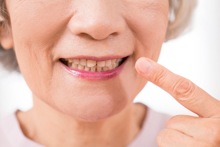 Implants: Why They Are More Important for Older Adults image 2