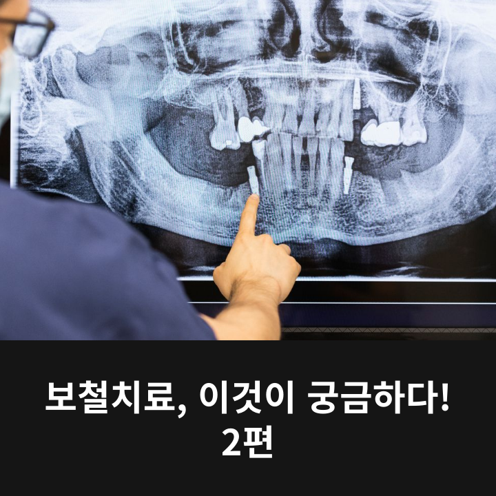 Prosthetic Treatment: What Are You Curious About? Part 2 image 4