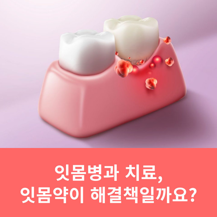잇몸병과 치료, 잇몸약이 해결책일까요? 관련 이미지 5