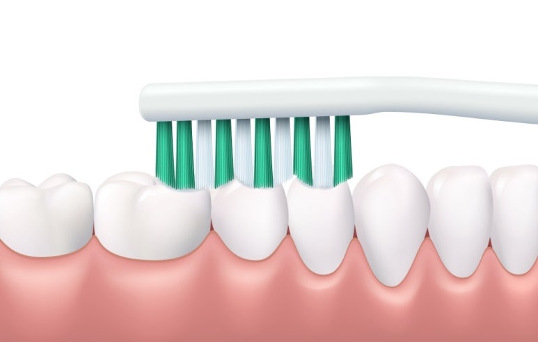 Prevention and Management of Periodontal Disease for Healthy Gums image 4