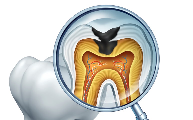 A Little Carelessness Can Lead to Tooth Loss! image 2