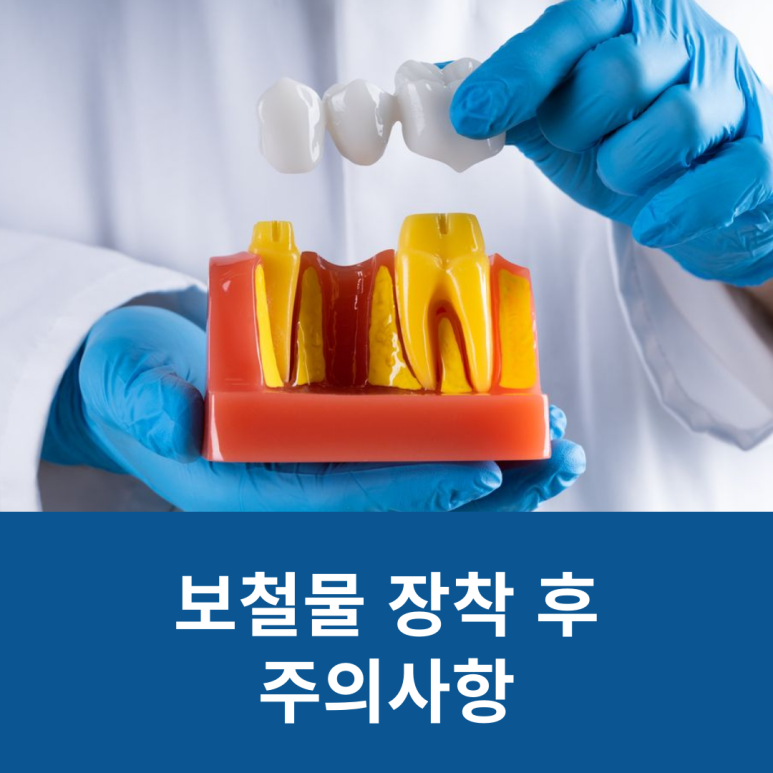 보철물 장착 후 주의사항 관련 이미지 7