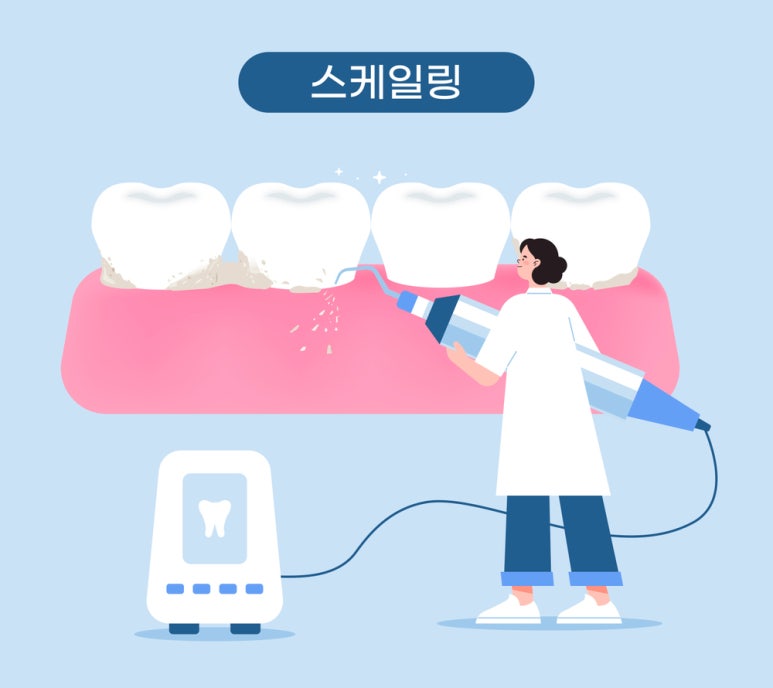 Prevention and Management of Periodontal Disease for Healthy Gums image 5