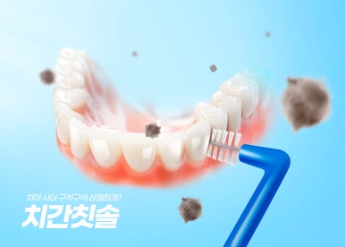 임플란트 오래 사용하려면 관련 이미지 6