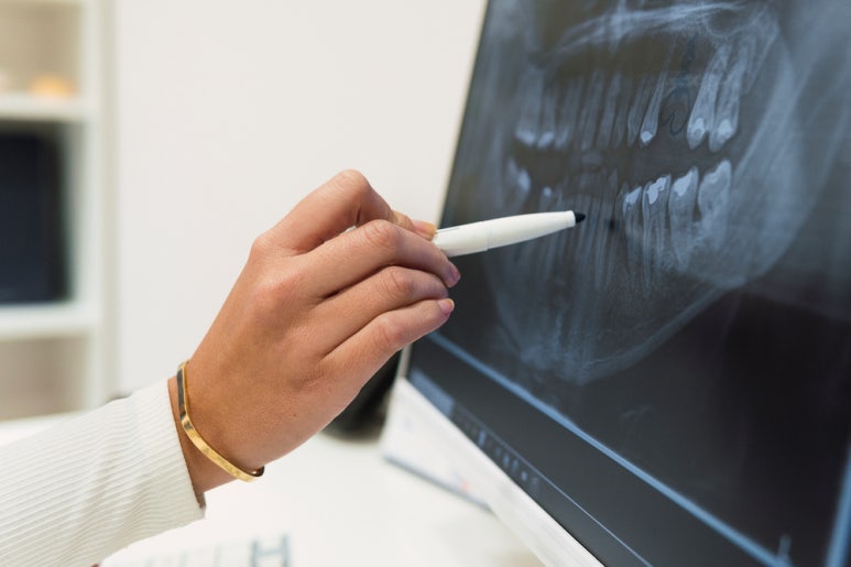 Implants: If You Don’t Take Care of Them, It’s a Waste of Effort! image 4