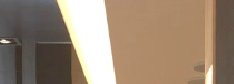 임플란트 치료 어려운 고령 환자라면 방법은? 관련 이미지 15