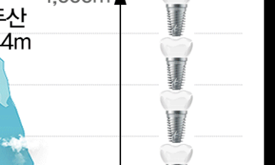 Dental Implant Bone Grafting: What Should You Be Careful About? image 22