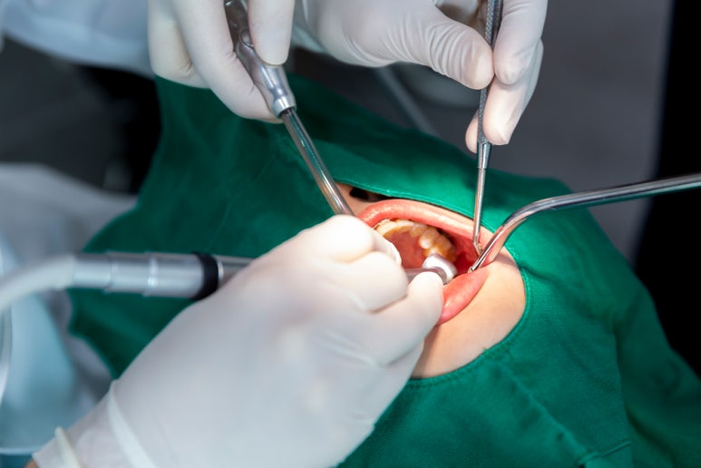 Why Should You Get Dental Implants image 5