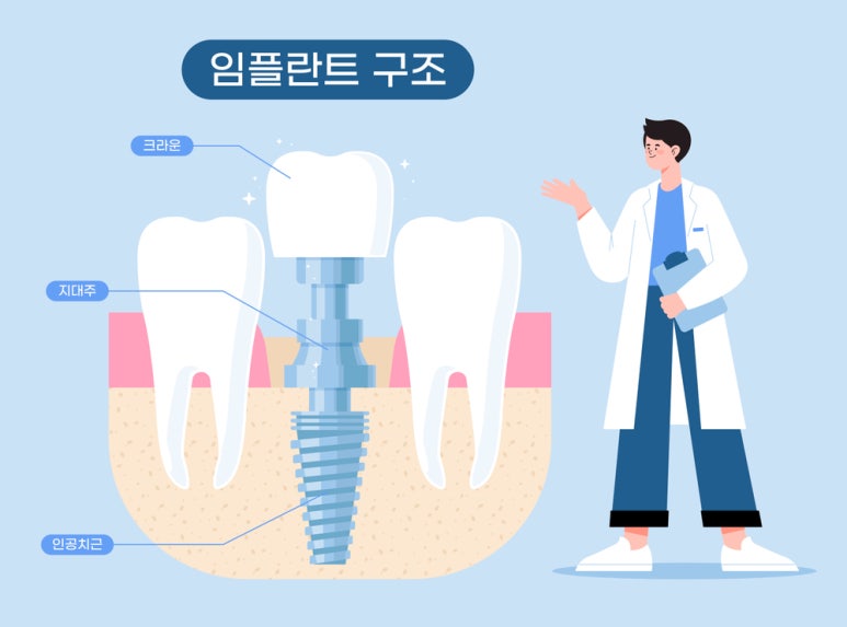Lost My Tooth! Restore It with an Implant! image 4