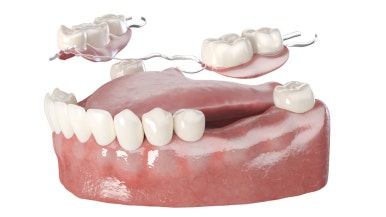 Prosthodontic Treatment: What You’re Curious About! Part 1 image 4