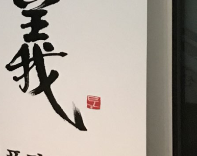 임플란트, 평생 사용할 수 있을까? 관련 이미지 22