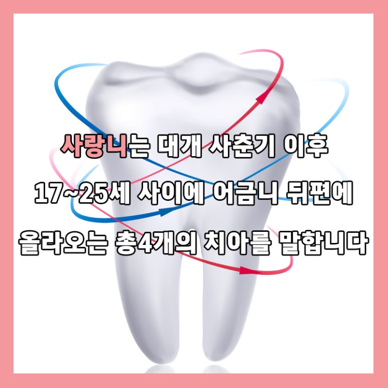 Dental Health Project with Seokplant - Is It Love, or a Wisdom Tooth? - image 2