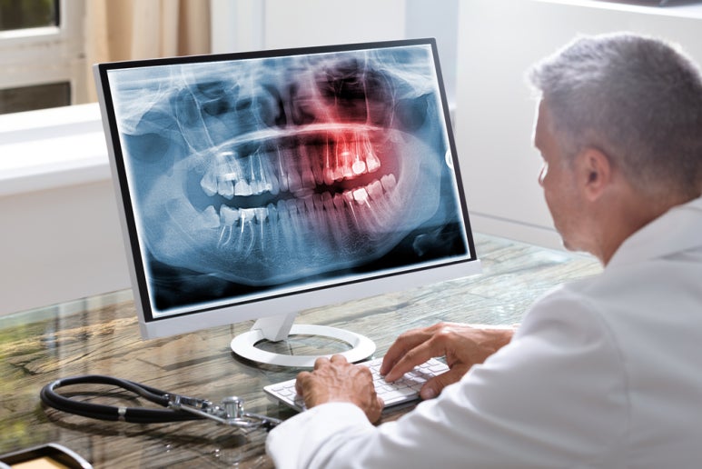 Implants: Why They Are More Important for Older Adults image 4
