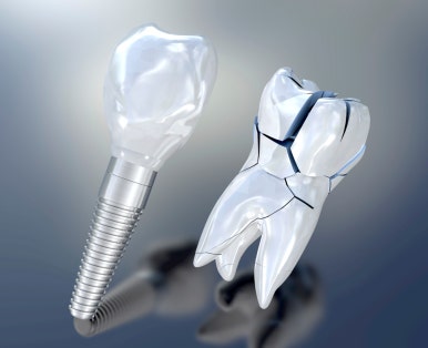 Could the reason appetite decreases with age be due to teeth? image 7