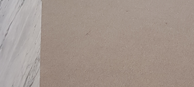 임플란트 오래 쓰려면 이렇게 하세요 관련 이미지 27
