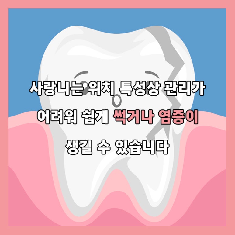Dental Health Project with Seokplant - Is It Love, or a Wisdom Tooth? - image 3