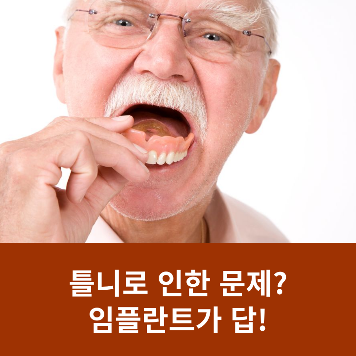 틀니로 인한 문제? 임플란트가 답! 관련 이미지 7