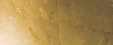 Implants: Treatment Timing and Aftercare Are Important! image 18