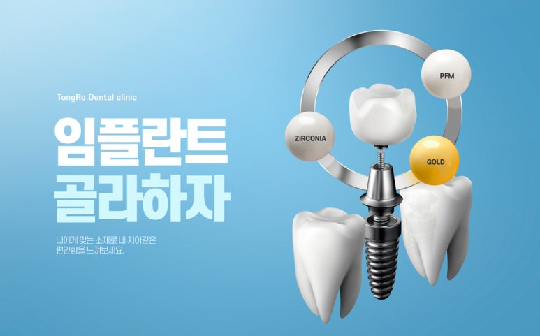 From Preparation to Care for Implants image 2