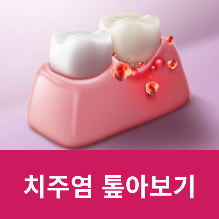 치주염 톺아보기 관련 이미지 5