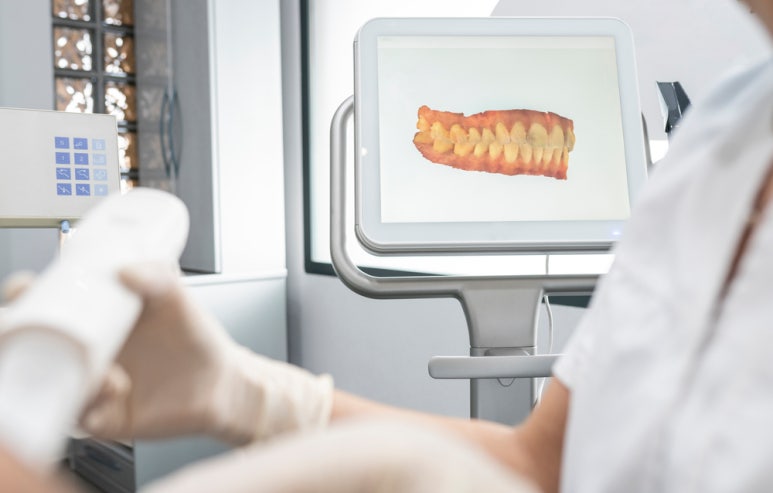 Implant Treatment Transformed by Digital Technology: Navigation Implants image 3