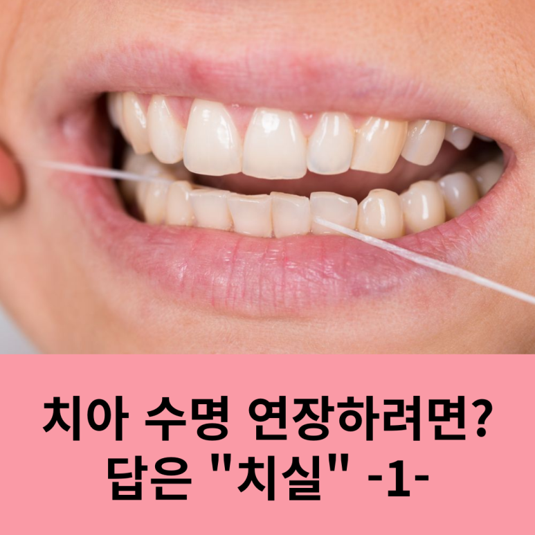 치아 수명 연장하려면? 답은 "치실" -1- 관련 이미지 6