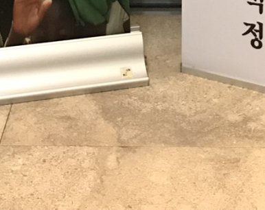 임플란트, 평생 사용할 수 있을까? 관련 이미지 24