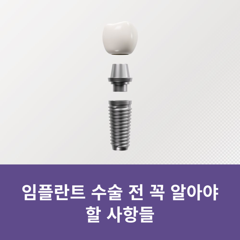 Things You Must Know Before Implant Surgery image 7