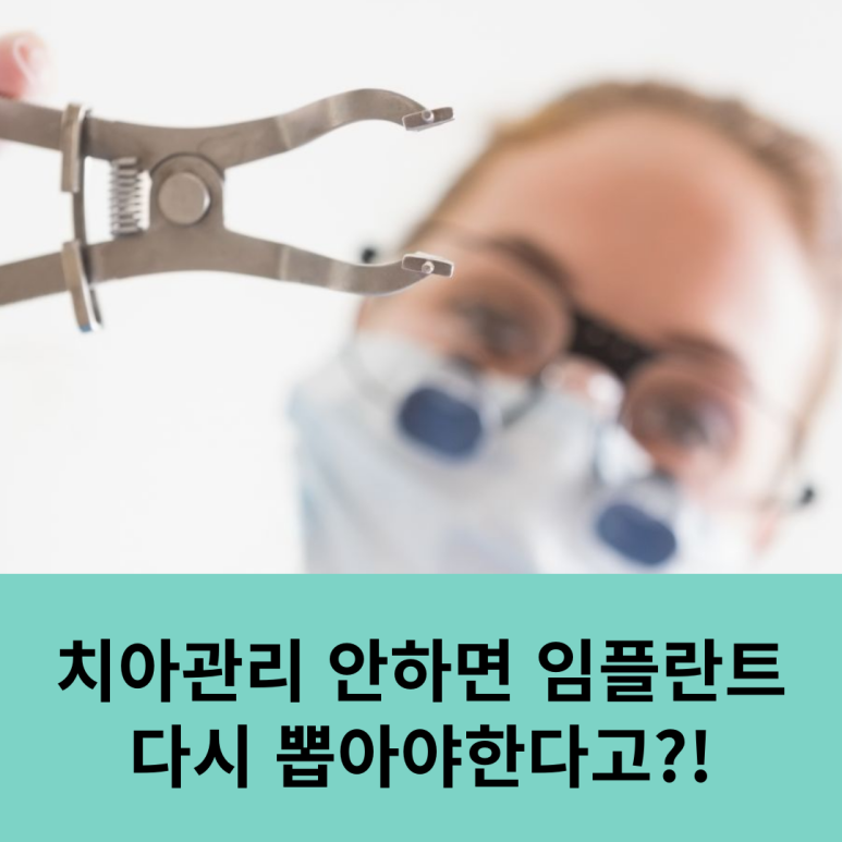 치아관리 안 하면 임플란트 다시 뽑아야 한다고?! 관련 이미지 18
