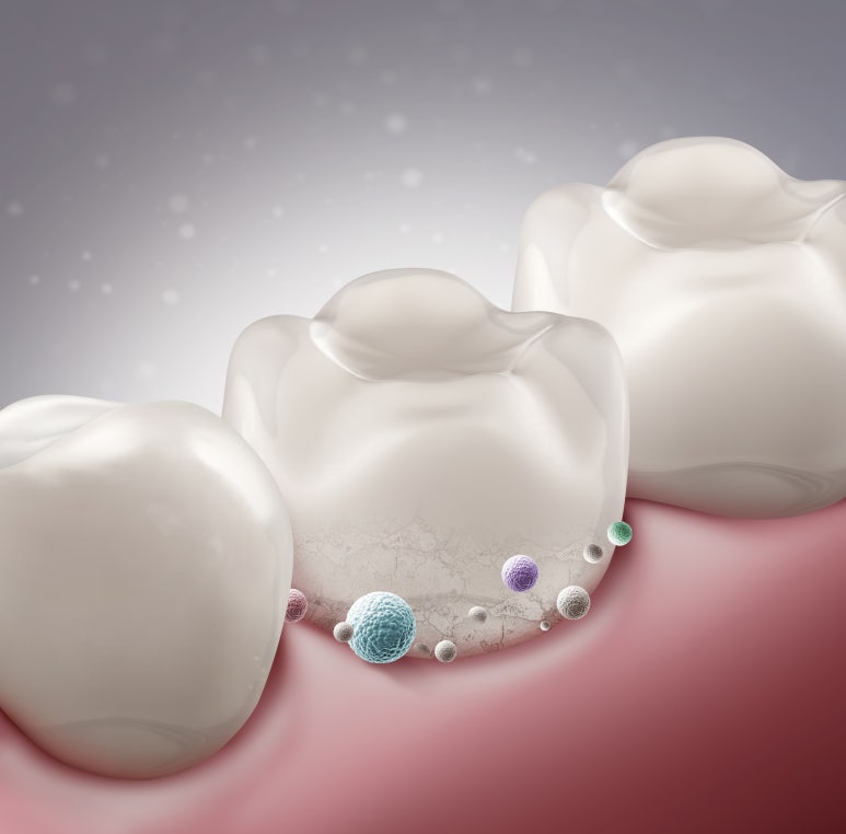Why You Should Go to the Dentist Even When Your Teeth Don’t Hurt image 9
