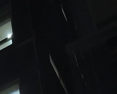 이가 빠졌을때, 임플란트 하세요 관련 이미지 13