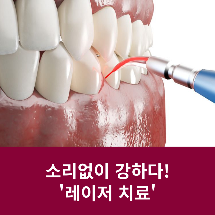 소리 없이 강하다! 관련 이미지 3
