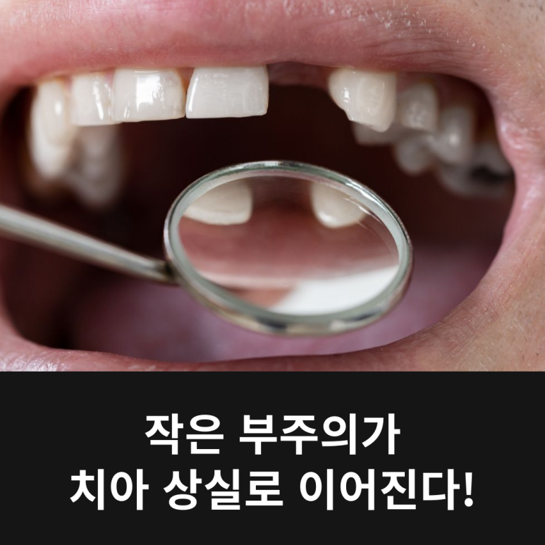 A Little Carelessness Can Lead to Tooth Loss! image 11