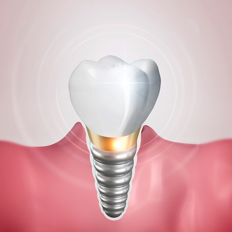 Seokplant Health Information - [Let’s Learn Basic Dental Health Facts] image 4