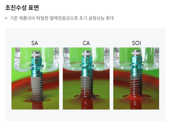 석플란트에서 오스템임플란트 궁금증 해결 관련 이미지 12