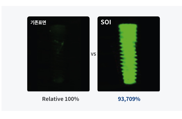 석플란트에서 오스템임플란트 궁금증 해결 관련 이미지 13