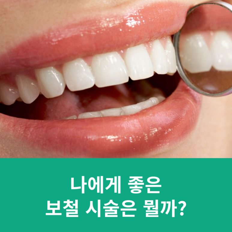 What Prosthetic Treatment Is Good for Me? image 7