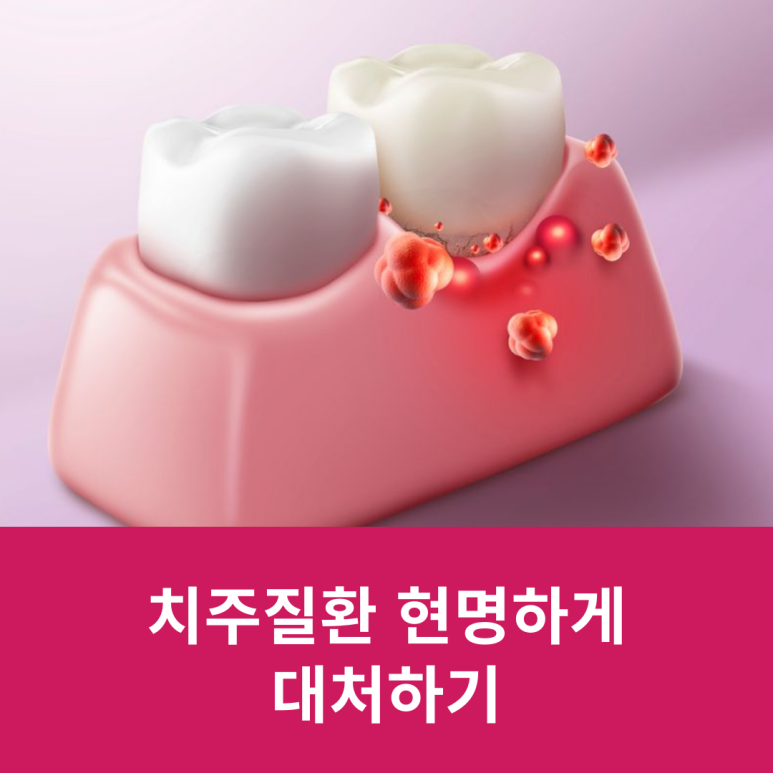 How to Deal with Periodontal Disease Wisely image 10