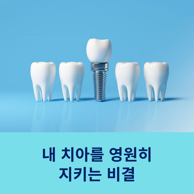 내 치아를 영원히 지키는 비결 관련 이미지 8