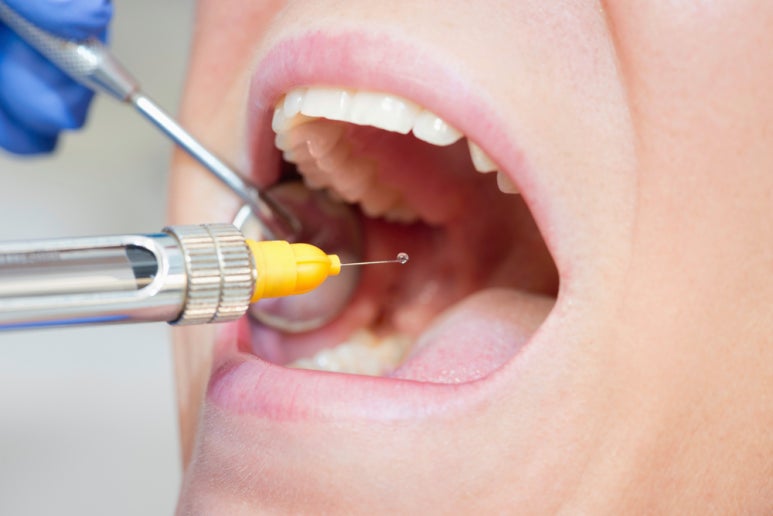 Things to Know After Dental Anesthesia image 2