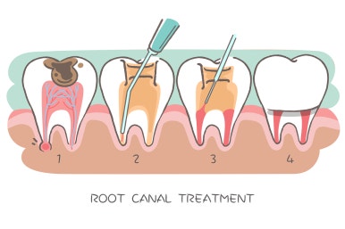 Prosthodontic Treatment: What You’re Curious About! Part 1 image 2